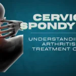 Cervical Spondylosis