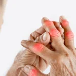 Combating Calcium Deficiency