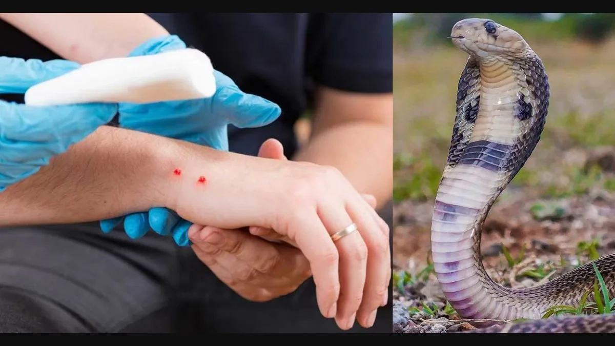 What To Do In Case Of A Snakebite