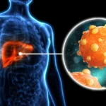 Learn More About Hepatitis