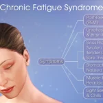 Chronic Fatigue & Immune Dysfunction Syndrome