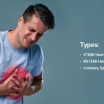 Major Causes and Types of Heart Attacks
