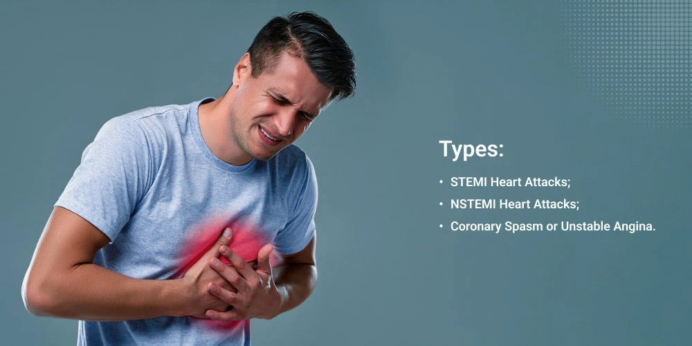 Major Causes and Types of Heart Attacks