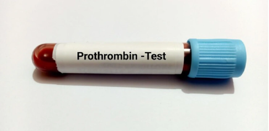 Prothrombin Time (PT) Test