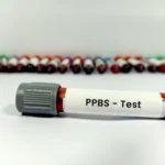 Blood Sugar Post Prandial Test