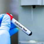 Calcium Test
