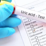 Uric acid Test