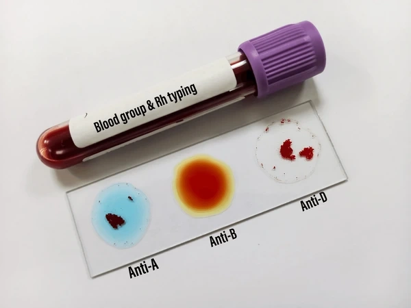 Blood grouping and Rh typing Test