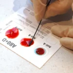 Blood grouping and Rh typing Test