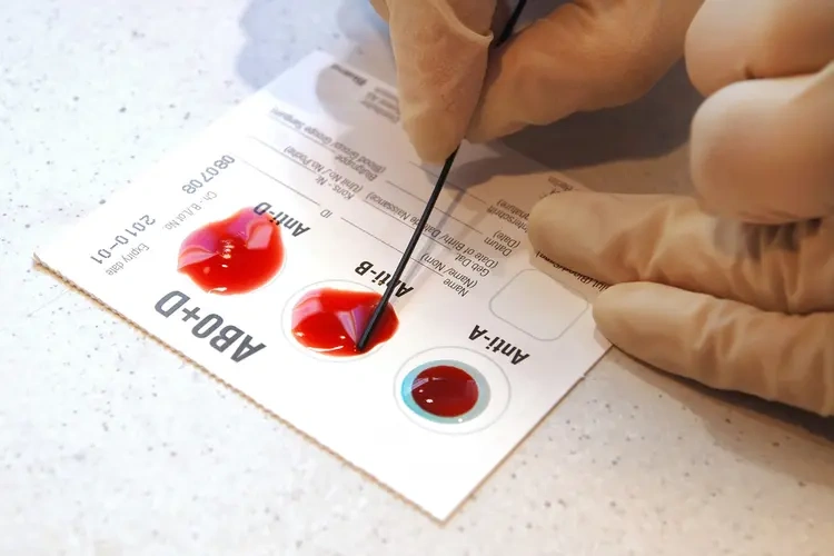 Blood grouping and Rh typing Test