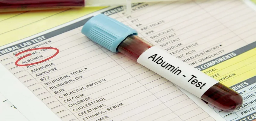 Albumin Test
