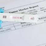 Alpha-Fetoprotein (AFP) Test