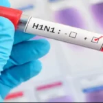 Swine flu - H1N1