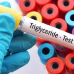Triglycerides Test