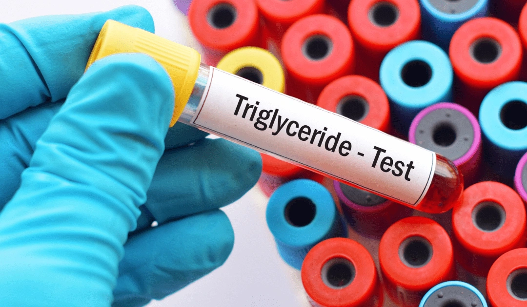 Triglycerides Test