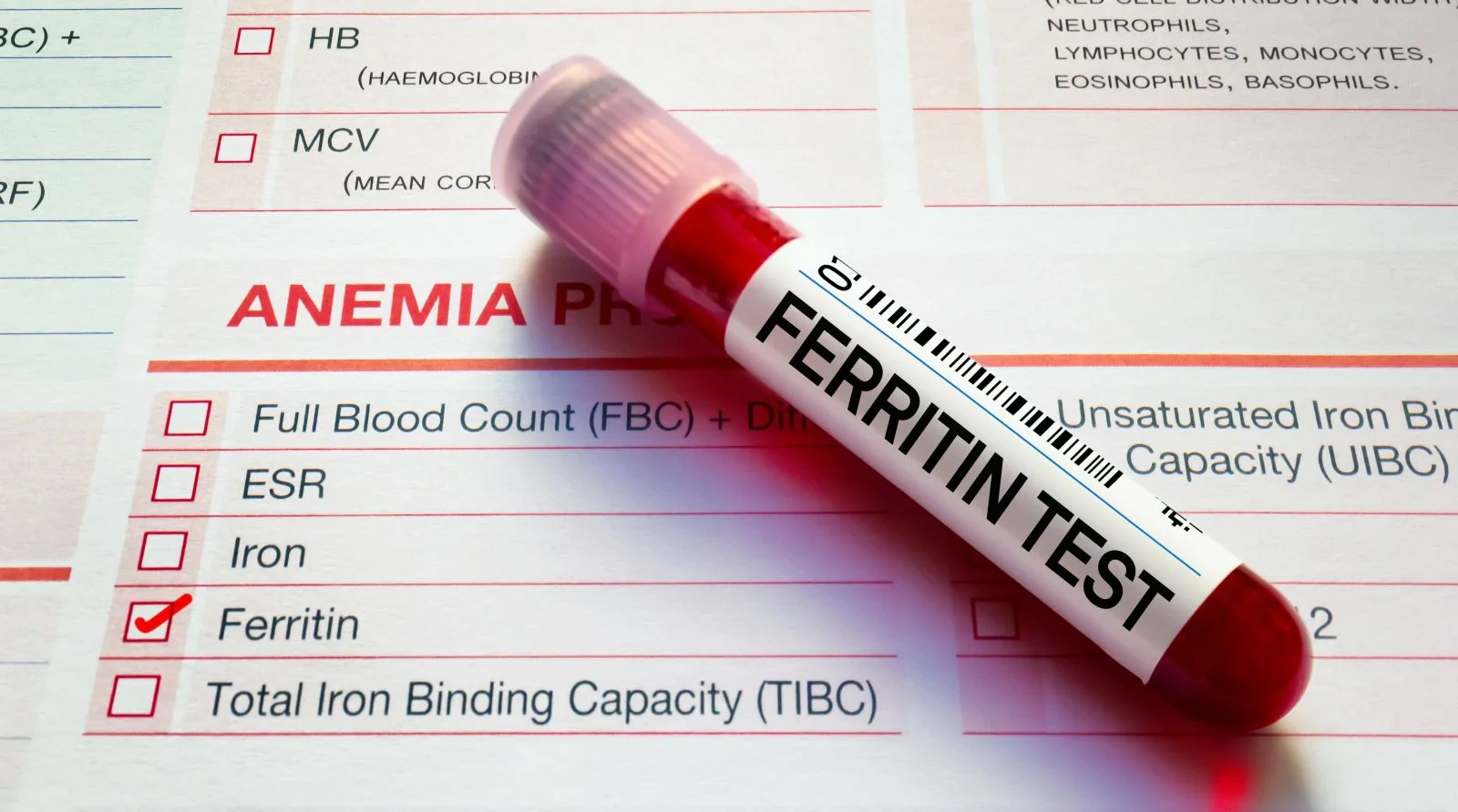 Ferritin Test