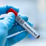Phosphorus Test