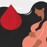 Antepartum hemorrhage