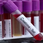 Creatinine Test