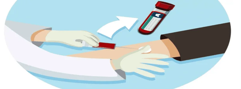 Gamma Glutamyl Transferase (GGT) Test