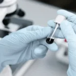 Glucose-6-phosphate dehydrogenase (G6PD) Test