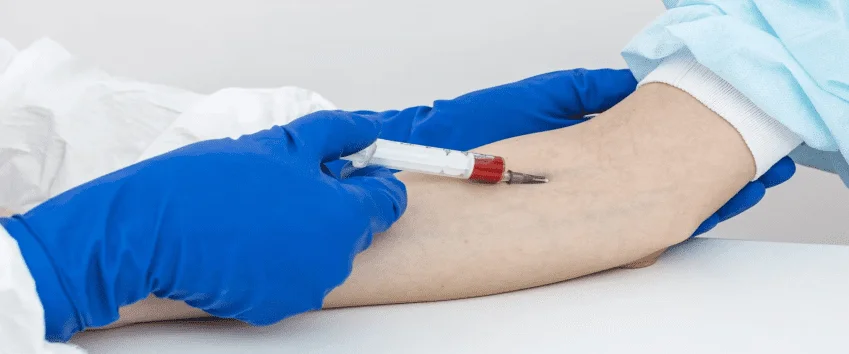 Lactate Dehydrogenase (LDH) Test