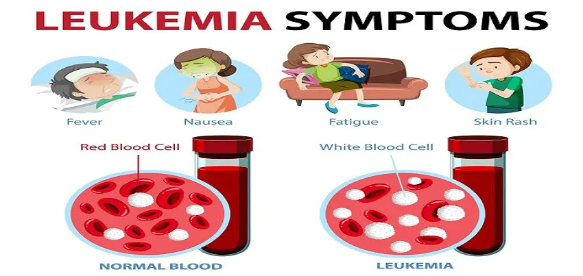 Leukemia