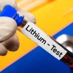 Lithium Test