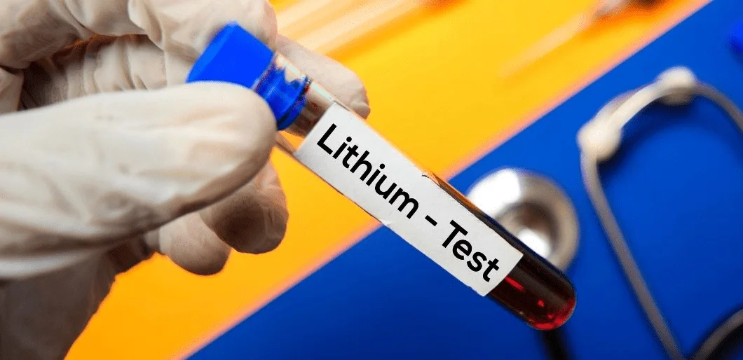 Lithium Test
