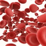 Iron deficiency anaemia