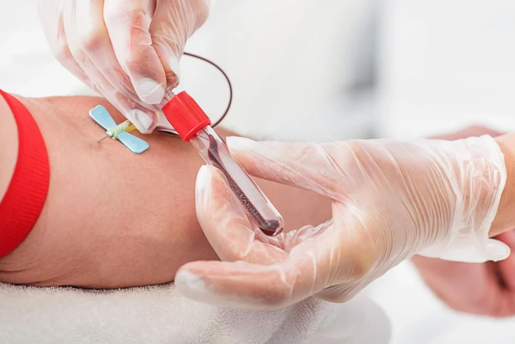 Pro B-type natriuretic peptide (proBNP) Test