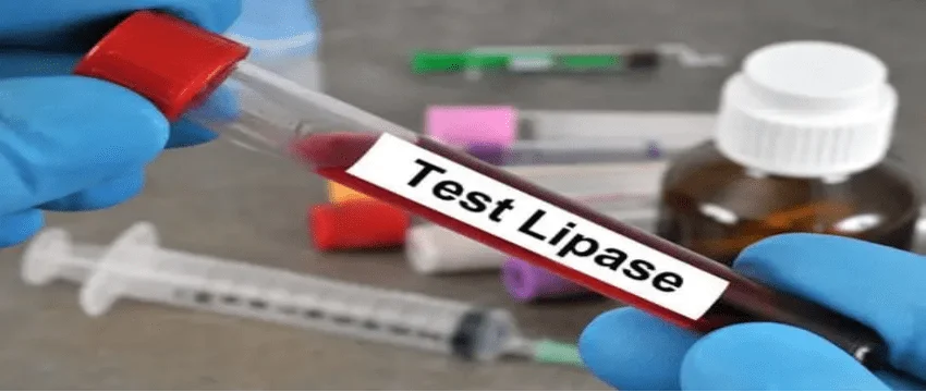 Lipase Test