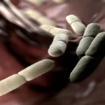 Acid-Fast Bacilli (AFB) Test