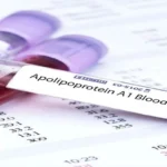 Apolipoprotein A-I (Apo A-I) Test