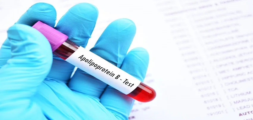 Apolipoprotein B (Apo B) Test