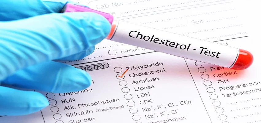 Cholesterol (Total) Test