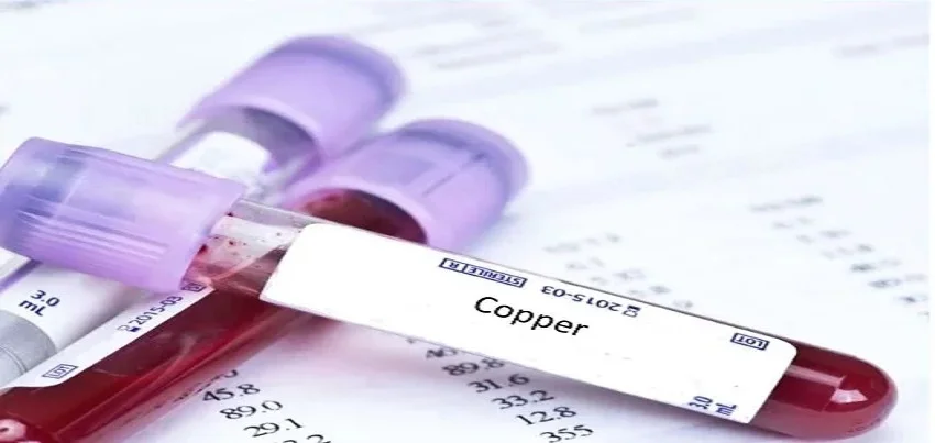 Copper Test