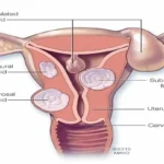 Fibroids Reproductive System