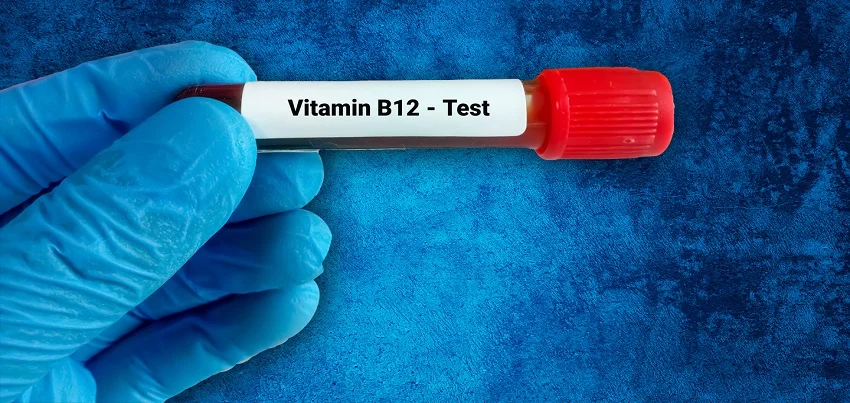 Vitamin B12 Test