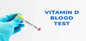 Vitamin D Test