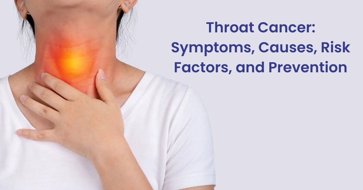 Throat Cancer – Types, Symptoms, Prevention and Treatment