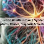 What-is-GBS-Guillain-Barre-Syndrome-Symptoms-Causes-Diagnosis-Treatment
