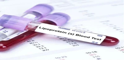 Lipoprotein (A) Blood Test – Lp(a)