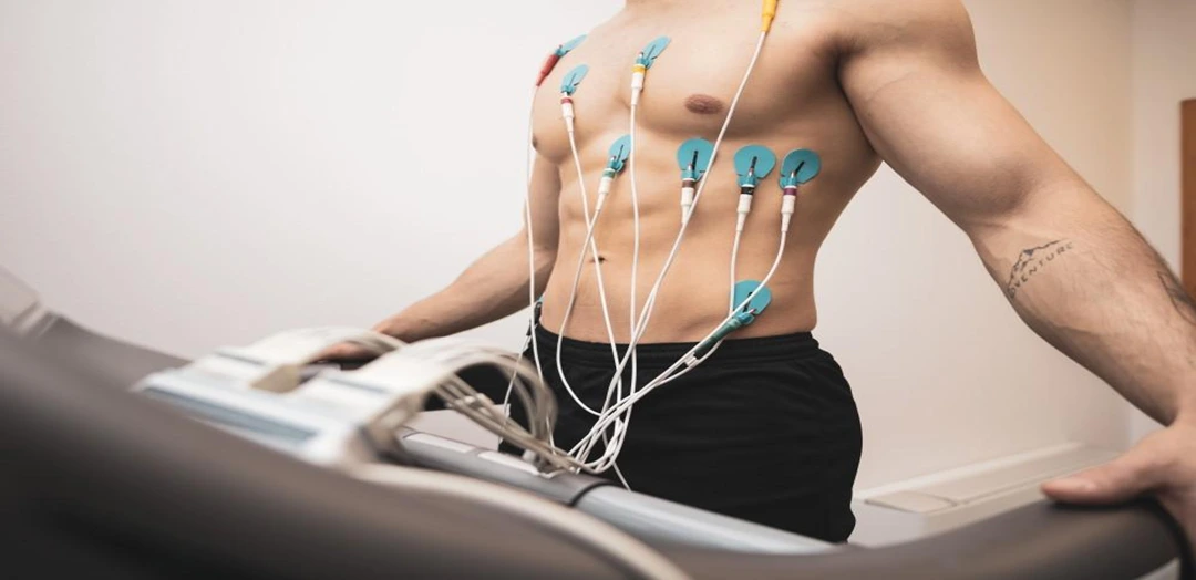Stress Test (Treadmill Test / TMT / Exercise Stress Test)
