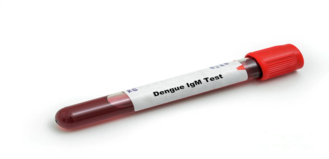 Dengue IgM Test
