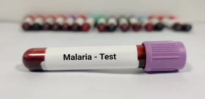 Malaria Parasite Test