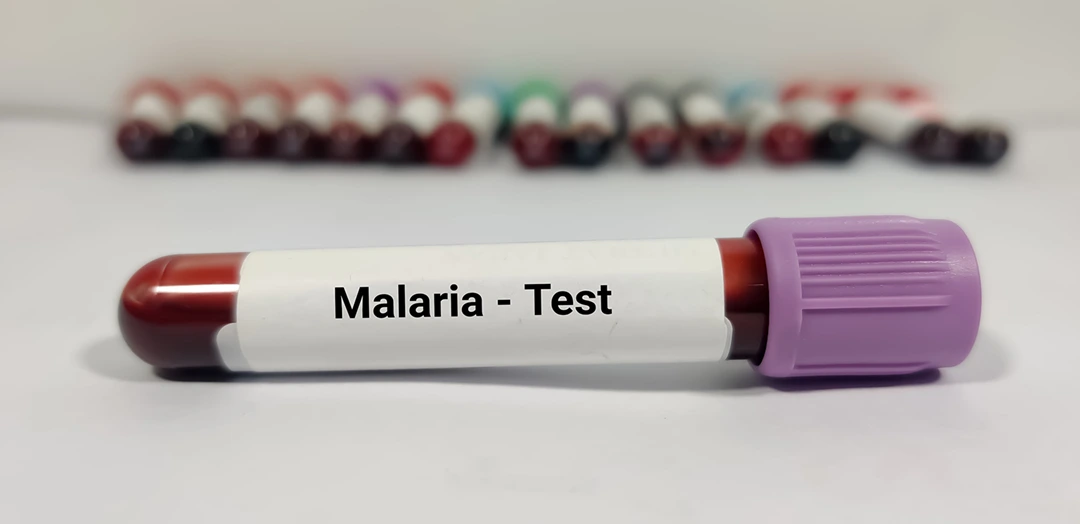 Malaria Parasite Test