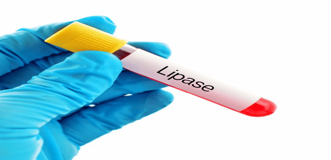 Lipase Blood Test