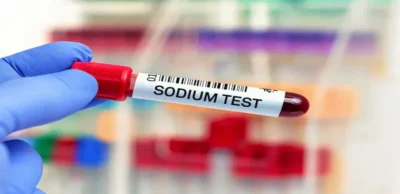 Sodium Blood Test