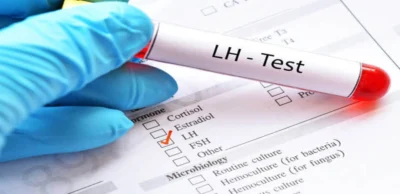 Leutinizing Hormone (LH) Test